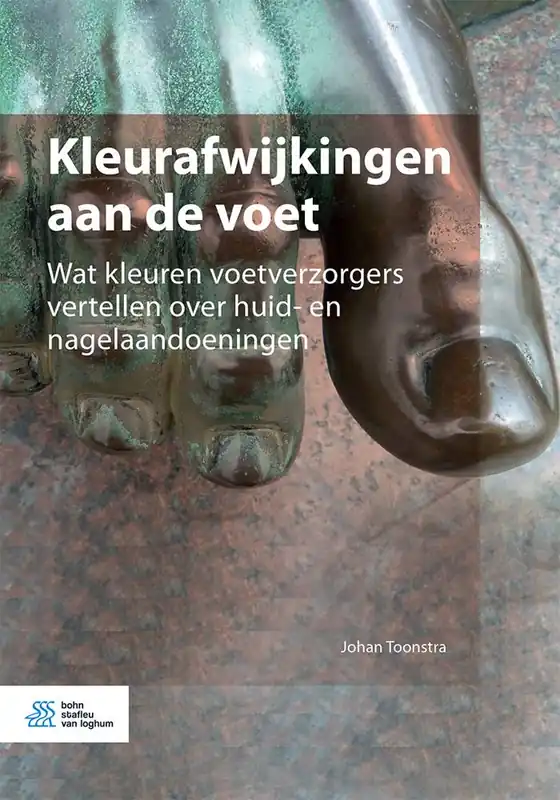 Finale Uitverkoop Kleurafwijkingen aan de voet / Druk 1