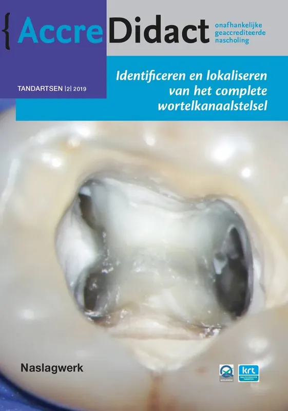 Fabrieksprijs Identificeren en lokaliseren van het complete wortelkanaalstelsel / Druk 1