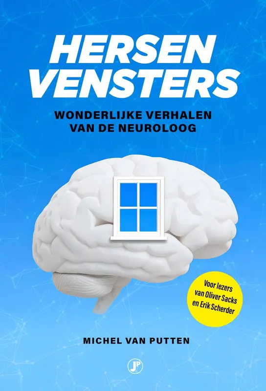 Hersenvensters / Druk 1 Koopje