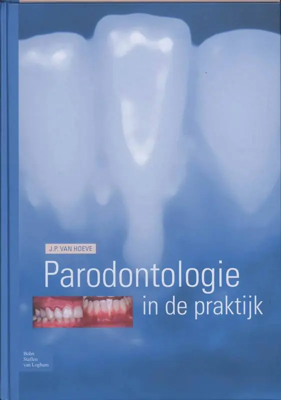 Express Levering Parodontologie in de Praktijk / Druk 1