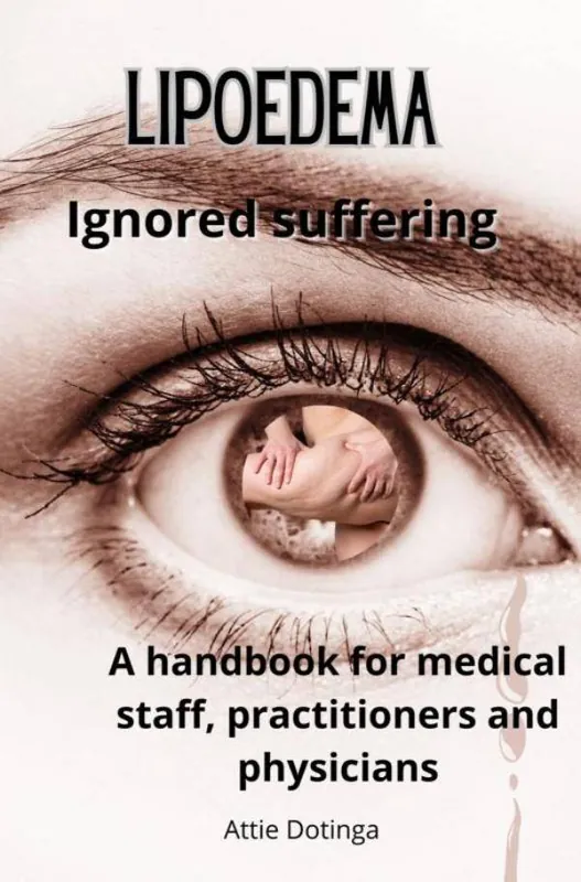 Koopje Lipoedema / 1st Edition