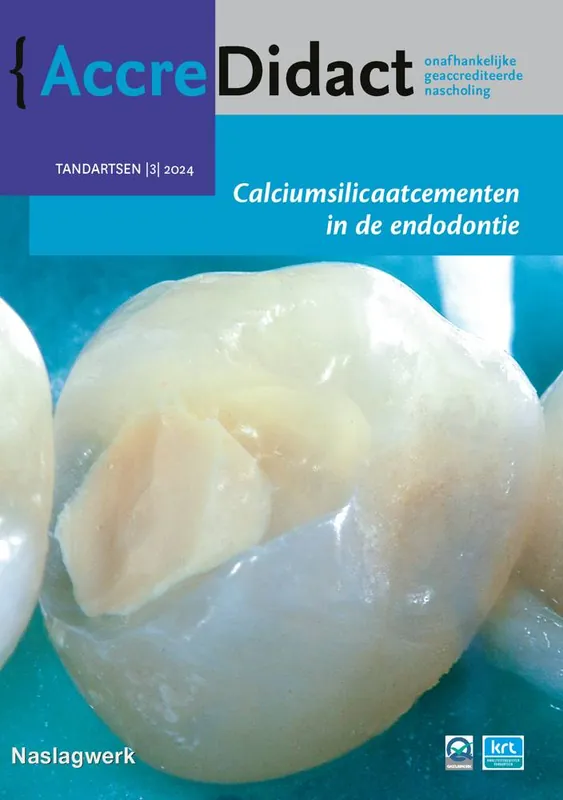 Meest Verkocht Calciumsilicaatcementen in de endodontie / Druk 1