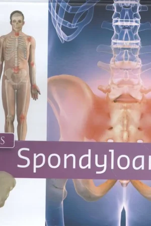 Zorgatlas Spondyloartritis / Druk 1 Populair