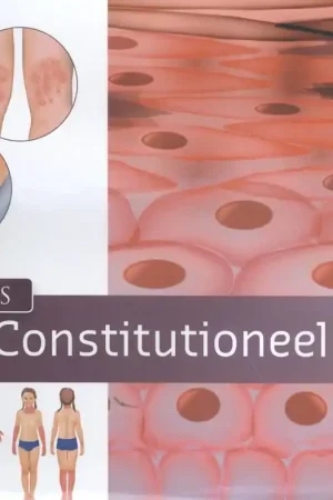 Beperkt Aanbod Zorgatlas constitutioneel eczeem / Druk 1