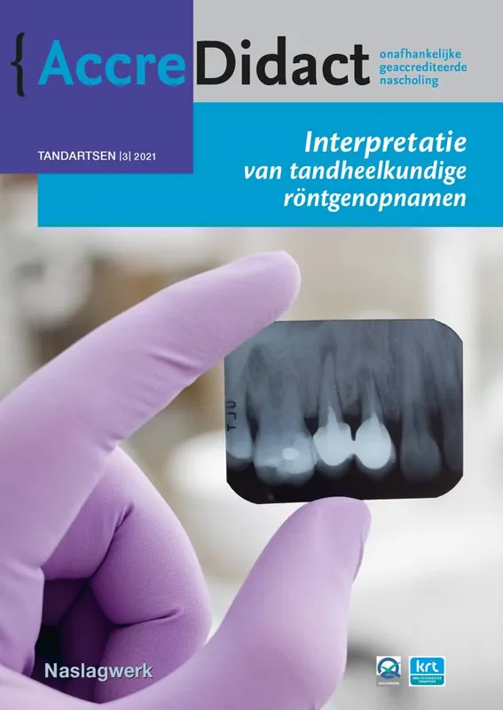 Interpretatie van tandheelkundige röntgenopnamen / Druk 1 Bestel Nu