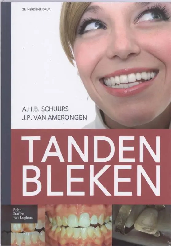 Tanden bleken / Druk 2 Superprijs