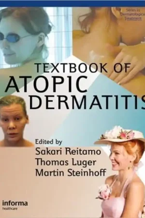 Textbook of Atopic Dermatitis - Sakari Reitamo Laatste Kans
