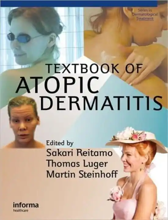 Textbook of Atopic Dermatitis - Sakari Reitamo Laatste Kans